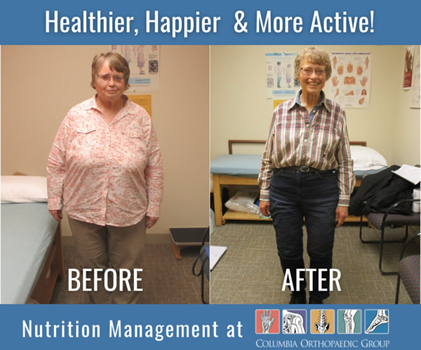 Hip Injury Leads to Weight Loss Transformation