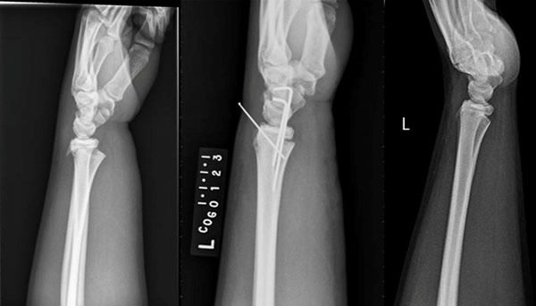 How Did a Deer Nearly End a Baseball Career