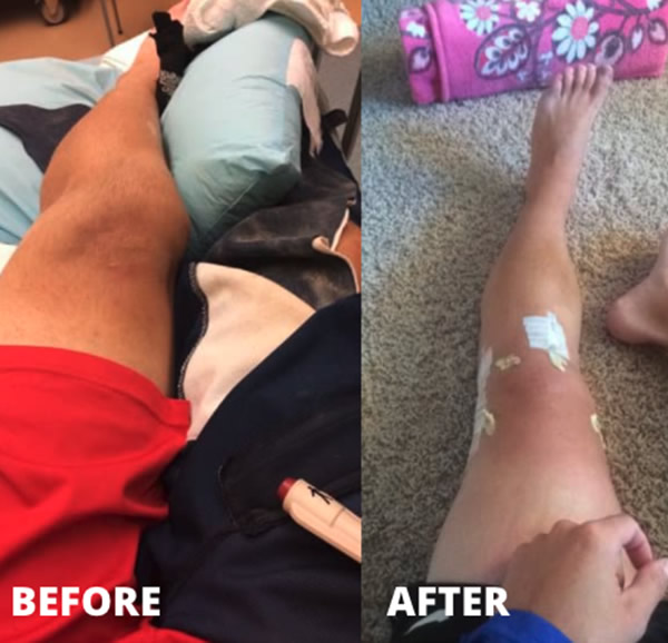 See How Much Damage a Softball Can Do!