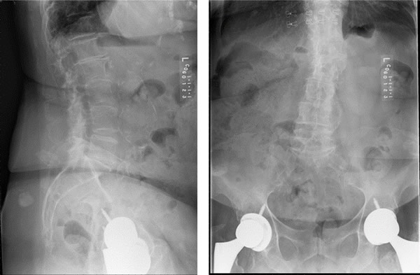 The Marvel of Being Pain-Free