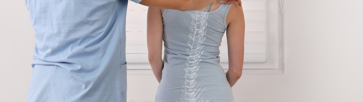 scoliosis